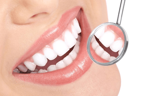 Everything You Need to Know About the Hollywood Smile Procedure
